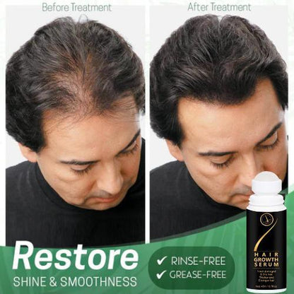 Hair Growth Serum for Damaged & Dry Hair 45ml